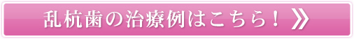 乱杭歯の治療例はこちら!