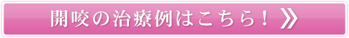 開咬の治療例はこちら！