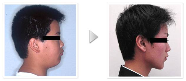写真：10代男性
